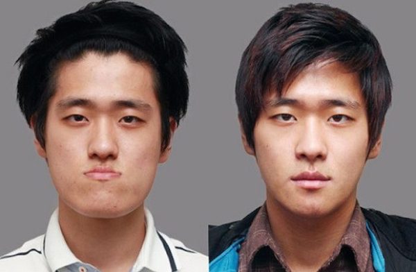 As cirurgias plásticas mais extremas da Coreia do Sul