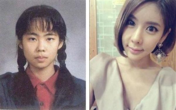 As cirurgias plásticas mais extremas da Coreia do Sul