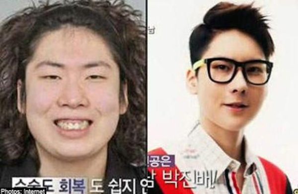 As cirurgias plásticas mais extremas da Coreia do Sul